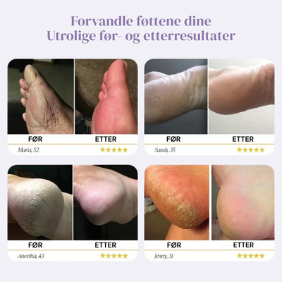 PediPro™ Elektrisk Fotfil