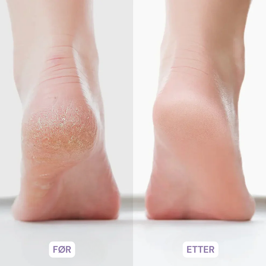PediPro™ Elektrisk Fotfil